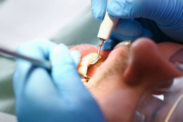 Best Walk-In Emergency Dentist in Coupeville, WA