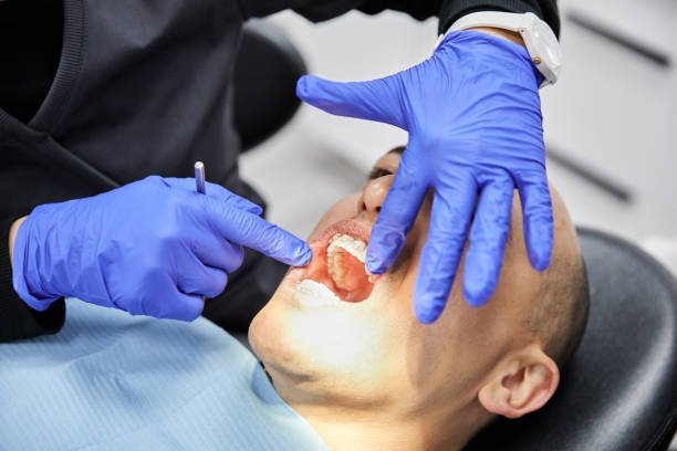 Best Emergency Tooth Extraction in Coupeville, WA